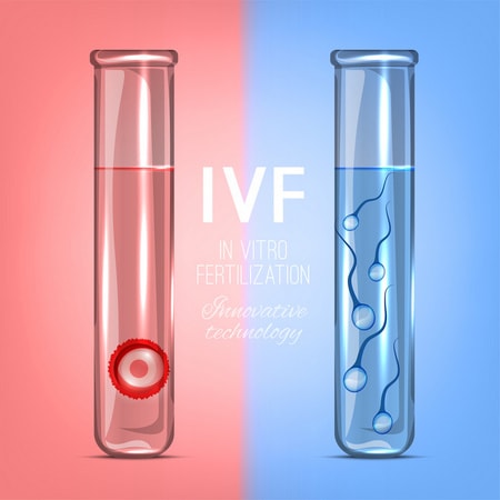 IVF-Artificial-Sperm